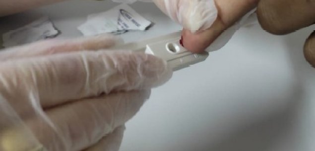 INTS disponibiliza teste gratuito para detecção de HIV