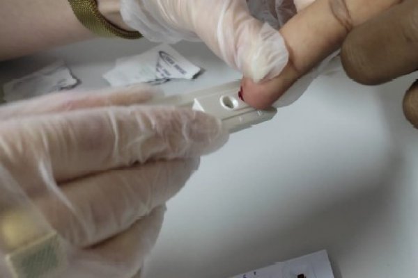 INTS disponibiliza teste gratuito para detecção de HIV
